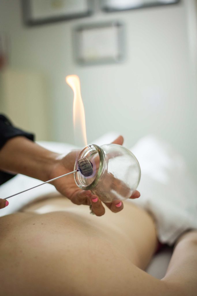 cupping and moxibustion